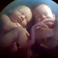 Jumeaux